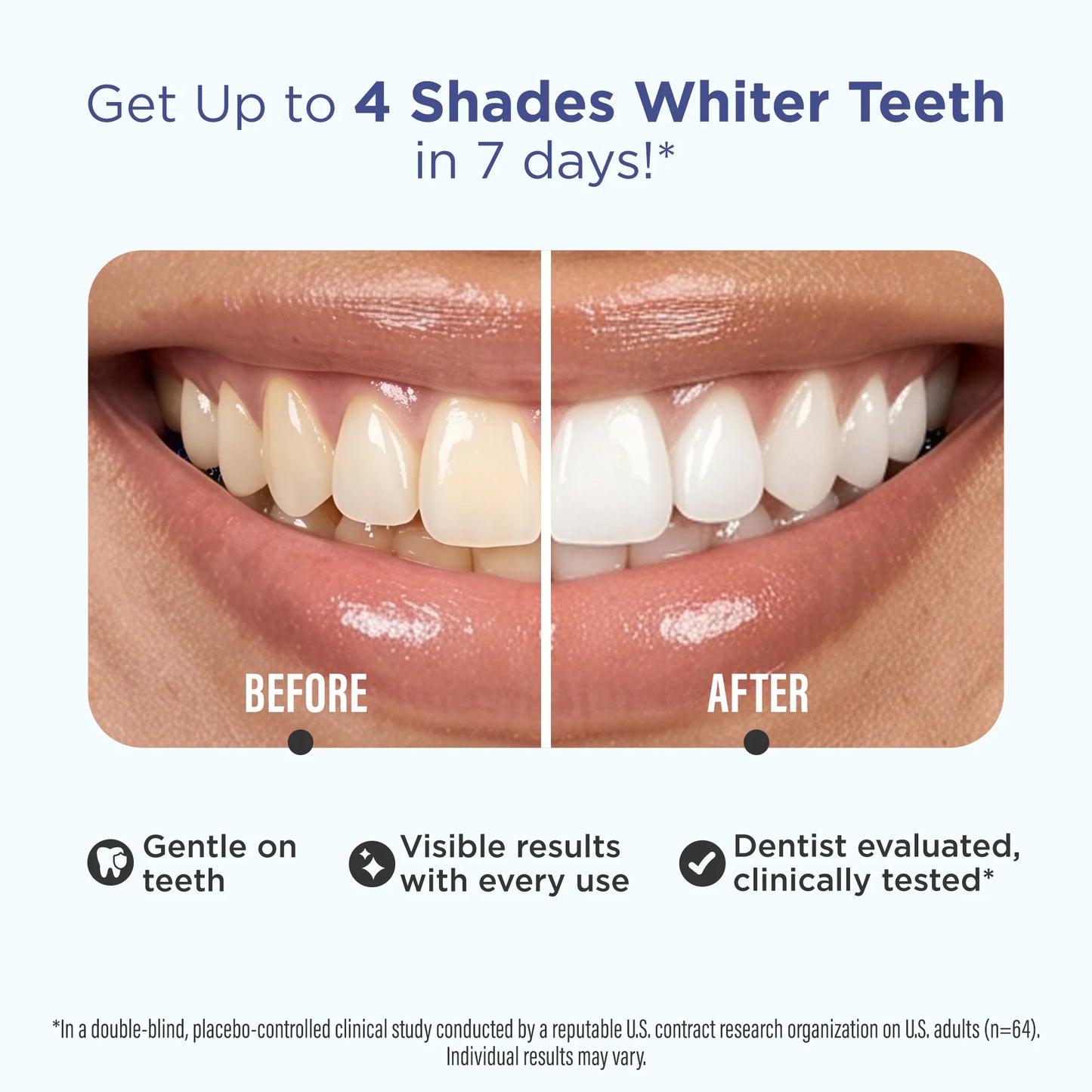 Whitening Strips
