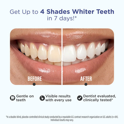 Whitening Strips
